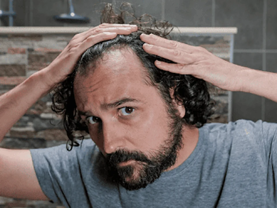 Traitement & Solutions perte de cheveux | Myla Bella Esthétique, Montréal