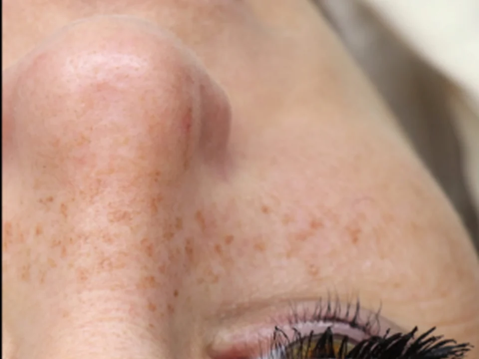 Velvet Myst - Clinique de dermopigmentation & régénération de la peau, Montréal