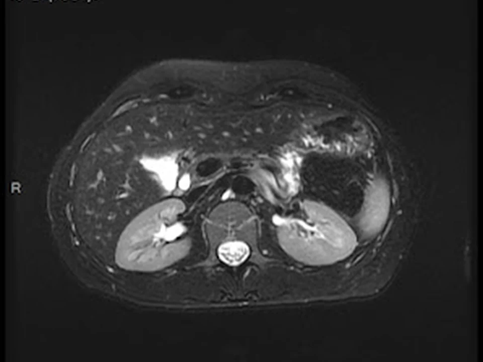 Diagnostic IRM - I.R.M. Radiologistes spécialisés. Tous nos examens sont à 690$. Rendez-vous à tous les jours, Montréal