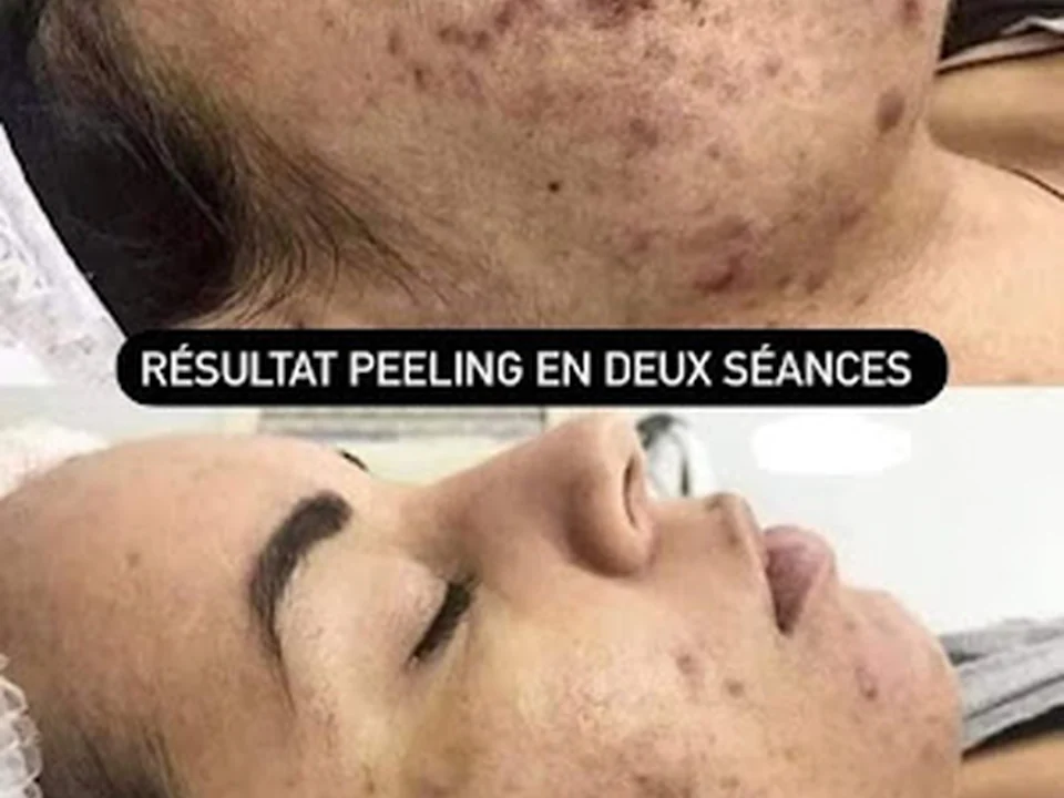 SLB Académie | Clinique Médico-esthétique et formation en soins esthétique à Laval, Montréal